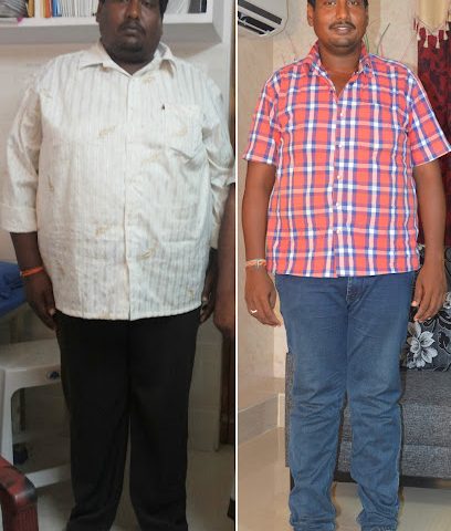 BEST BARIATRIC AND OBESITY CLINIC - الدوحة، - +91 88818 38888